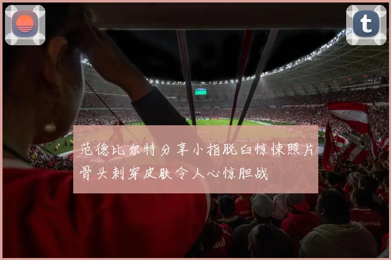范德比尔特分享小指脱臼惊悚照片骨头刺穿皮肤令人心惊胆战